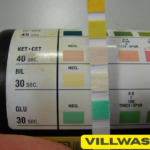 Reagent Strip Test for Urine: Procedure, Parameters, Results, and Clinical Uses Explained